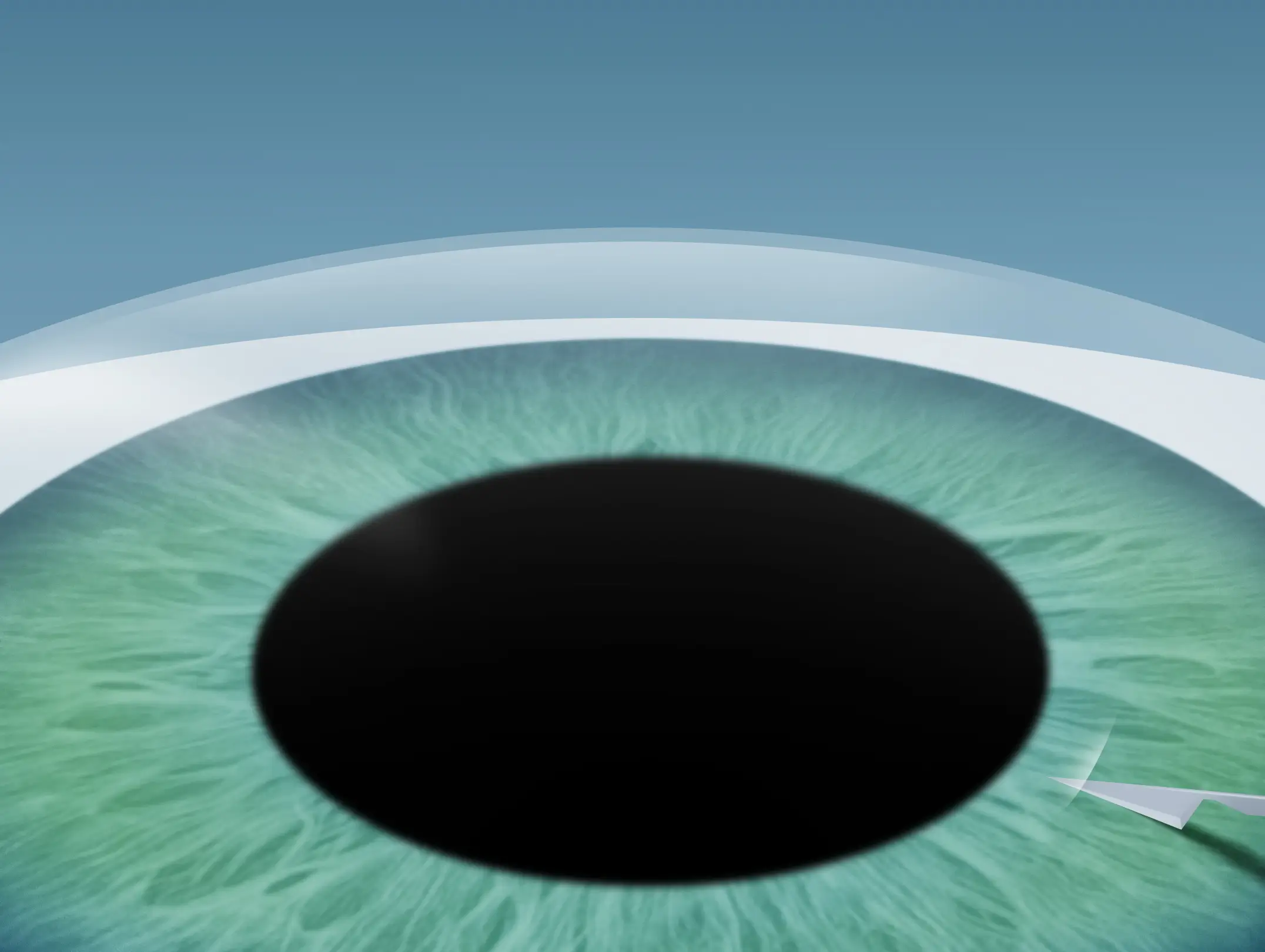 1. Schritt ICL OP - Linsenchirurgie in Düsseldorf und Wuppertal